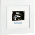 CADRE ECHOGRAPHIE BLANC