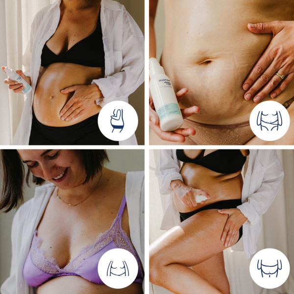 Huile anti vergeture grossesse Babymoov
