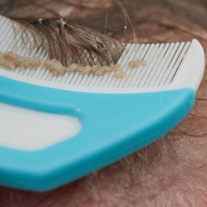 Kit 3-en-1 croûtes de lait bébé Frida